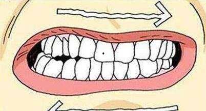 磨牙成人制作方法视频-第3张图片-草莓视频深夜