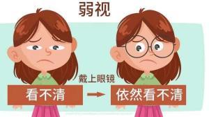 成人弱视能恢复吗视频-第2张图片-草莓视频深夜